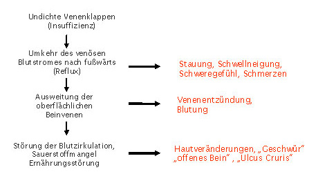 Varizen Ursachen Grafik